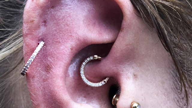 Daith-Helix_Mariatashnijmegen_Diamond Segment Clicker